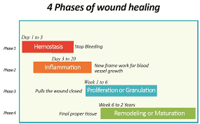 4 Phases Wound Healing Wound Care Nursing Wound Care Wounds Nursing