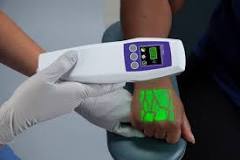 Vein Visualization System | AccuVein, Inc.