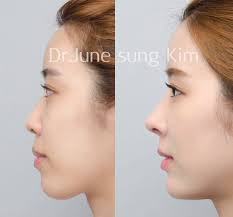 Solongosiin Goo Saihnii Mes Zasliin Emneleg