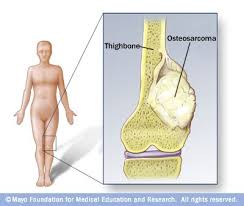 Pin On Everything Orthopaedic