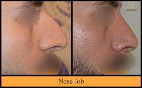 See more ideas about perfect nose, beauty, makeup looks. How To Get Perfect Nose Shape With In 7 Days Dr Monisha Kapoor