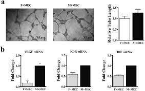Ltd in china @aliyun.com mail. Comparison Between Mandibular And Femur Derived Bone Marrow Stromal Cells Osteogenic And Angiogenic Potentials In Vitro And Bone Repairing Ability In Rsc Advances Rsc Publishing Doi 10 1039 C7ra07139f