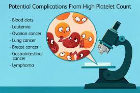 High Platelet Count: When To Worry