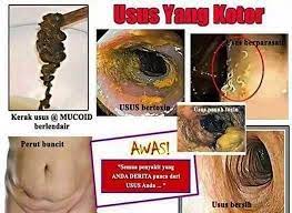 We did not find results for: Cara Mudah Kempiskan Perut Buncit Dalam 3 Hari Az Online Shop