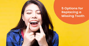 The average price of a tooth bridge varies depending on several factors. 5 Options For Replacing A Missing Tooth Bloor West Smiles