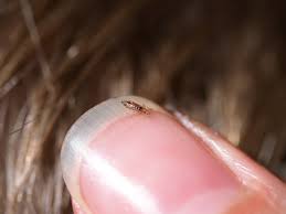 Image result for lice vs nits