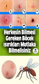 Herkesin Bilmesi Gereken Bocek Isiriklari Mutlaka Bilmelisiniz Bocek Dogal Saglik Saglikli Yasam