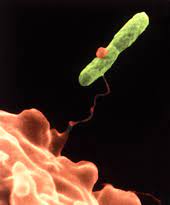Sometimes the bacteria infects the lungs and can cause a severe pneumonia called legionnaires' disease. Legionella Wikipedia