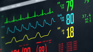 Normal Vital Signs On Bedside Stock Footage Video 100 Royalty Free 20286292 Shutterstock