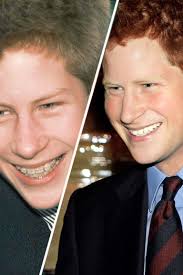 Prince charles and camilla parker bowles. Famous Faces With Braces Faith Hill And More Celebrities Who Had Braces