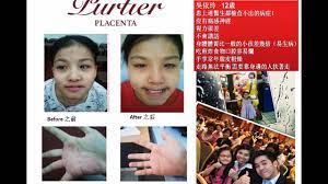 Start your plan to maintain your youth and keep your body. Purtier Testimonials ä¸­æ–‡ Youtube
