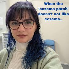 Spot Diagnosis Podcast: Cutaneous T Cell Lymphoma with Dr Friyana Bhabha