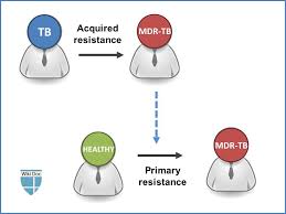 Latent infection and active disease. Multi Drug Resistant Tuberculosis Natural History Complications And Prognosis Wikidoc