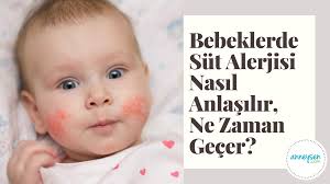 Ozellikle Ek Gidaya Gecisle Birlikte Bebeginin En Cok Faydalanacagini Dusundugun Urunler Muhakkak Sut Ve Sut Urunleri Ancak Bazi Bebek Bebek Hamilelik Urunler