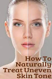 How To Fix Uneven Skin Tone And 2 Proven Ways To Prevent It Dull Skin Dull Skin Remedies Skin