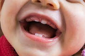 Wann brechen die ersten zähne durch? Zahnende Babys Und Die Ersten Zahne Zwergehuus Magazin