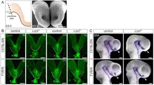 Shhh i love you novel. Identification Of Novel Disease Relevant Genetic Modifiers Affecting The Shh Pathway In The Developing Brain Biorxiv