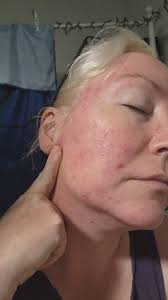 Bone char in kitchen sink water filters