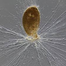 Image result for Raphidiocystis