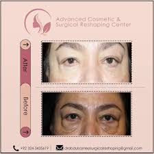 Advanced Cosmetic and Surgical Reshaping Center (@dr.abdulsamee) •  Instagram photos and videos