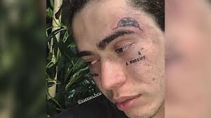 Um fã do youtuber whindersson nunes, identificado como rafael xavier, resolveu fazer uma tatuagem de seu ídolo na perna. Kfmec2yrvy Npm