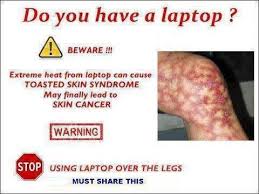 Toasted Skin Syndrome From Laptop Warning Hoax Slayer