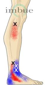 Pin On Health