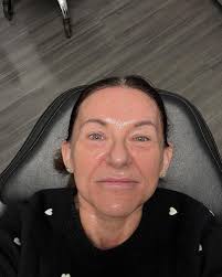 Ageless Skin Rejuvenation Med-Spa