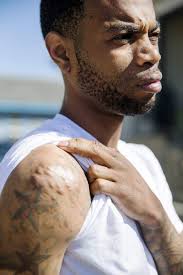 New Orleans man shot in 2014 robbery gets a chance to thank young doctor  who kept him alive