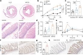 Which inference does this passage support? Dietary Fructose Improves Intestinal Cell Survival And Nutrient Absorption Nature