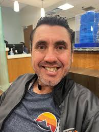 Has anyone experienced Bell's palsy?