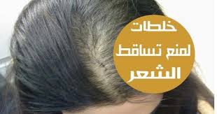 الشعر له دور محوري هام في تحديد مظهرنا وجمالها لهذا السبب نفقد نومنا بسبب مشكلة تساقط الشعر فقدان الشعر يمكن أن يكون سببا رئيسيا لفقدان الثقة بالنفس فقدان حوال
