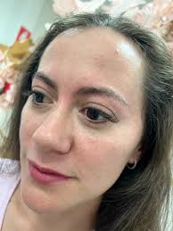 Ananateramicropigmentacion