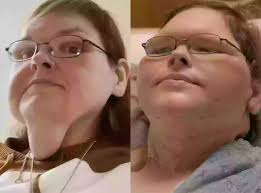 1000-lb Sisters' Tammy Slaton reveals major skin removal transformation