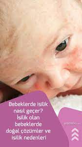 bebeklerde isilik nasil gecer isilik olan bebeklerde dogal cozumler ve isilik nedenleri bebek yenidogan bakimi hamilelik sonrasi
