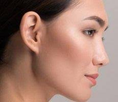 Rhinoplasty Specialist