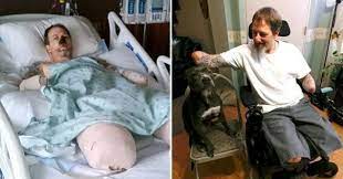 Signora azzannata dal cane da guardia, in ospedale. Il Cane Di Casa Lo Lecca Il Padrone 49enne Contrae Un Infezione Braccia E Gambe Amputate