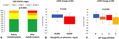 Check spelling or type a new query. Short And Long Term Renal Outcomes Following Severe Rhabdomyolysis A French Multicenter Retrospective Study Of 387 Patients Springerlink