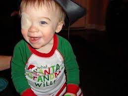Good Tips On Patching For Toddlers With Eye Problems Such As Cataract And Strambismus Just In Case Ethan Has To Have One Toddler Toddler Wearing Baby Eyes