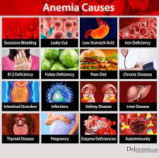 Anemia: Causes, Symptoms And Support Strategies - Drjockers.com