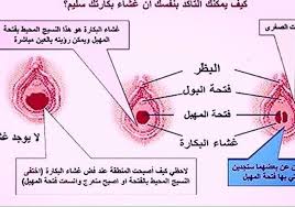 تركيب غشاء بكارة بنفسك ما هو غشاء البكارة وانواعه حلوه خيال