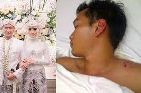 Wanita tersebut menggugat rezky aditya atas pengakuan anak, nafkah dan juga perbuatan melawan hukum. Akui Nikah Tanpa Pacaran Citra Kirana Sempat Kepergok Temani Rezky Aditya Selama Koma Saat Bahu Kanannya Retak Semua Halaman Grid Health
