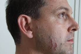 Gerard Baden-Clay given life sentence for murder of wife Allison