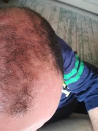 Uraw Mavi Serum Kullanici Yorumlari