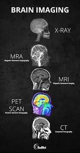Brain Imaging Medical Knowledge Brain Images Radiology Student