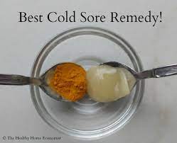 Pin On Natural Remedies