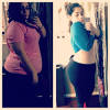 This procedure is one of the most effective in terms of expected weight loss. 1