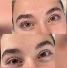 Klézl Boglárka kozmetikus