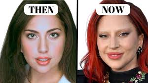 How Much Plastic Surgery Has Lady Gaga Had