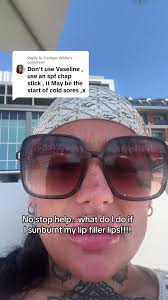 Sunburned Lip Filler: What to Do When Your Lips Burn